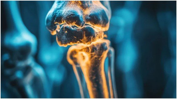 Which One Is Better for Bone Health?