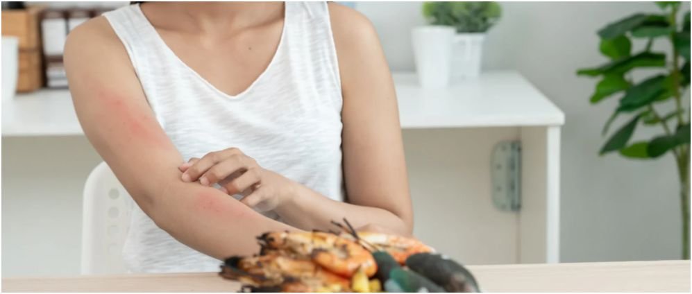 food allergy and food intolerance