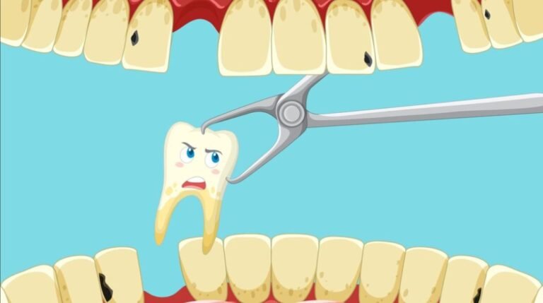 Why Delaying Tooth Extraction Can Cause Bigger Problems in Falls Church